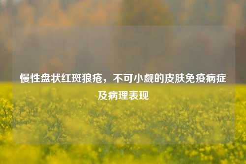 慢性盘状红斑狼疮，不可小觑的皮肤免疫病症及病理表现